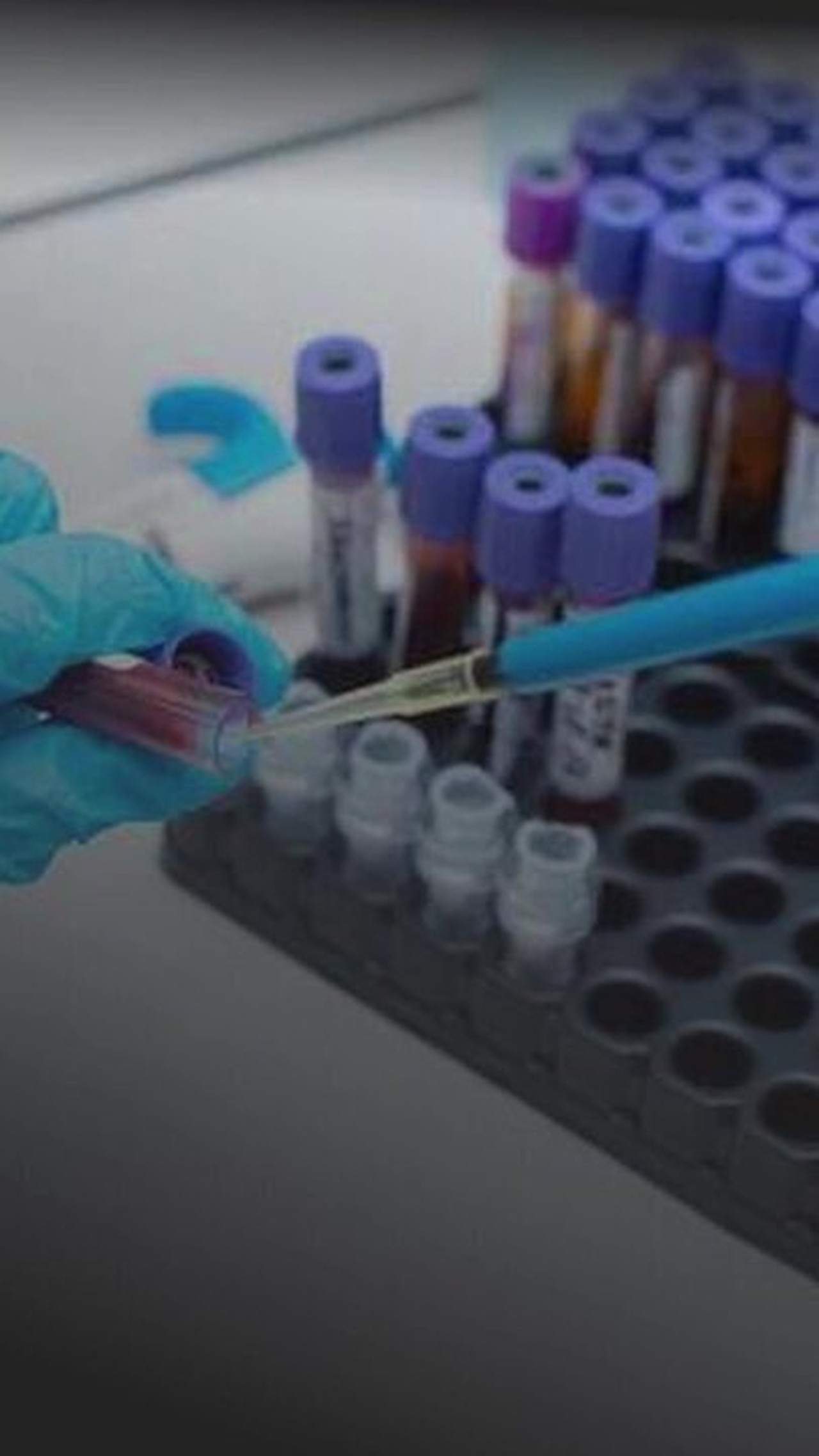 Cinco mudanças de estilo de vida para ajudá-lo a viver mais e melhor