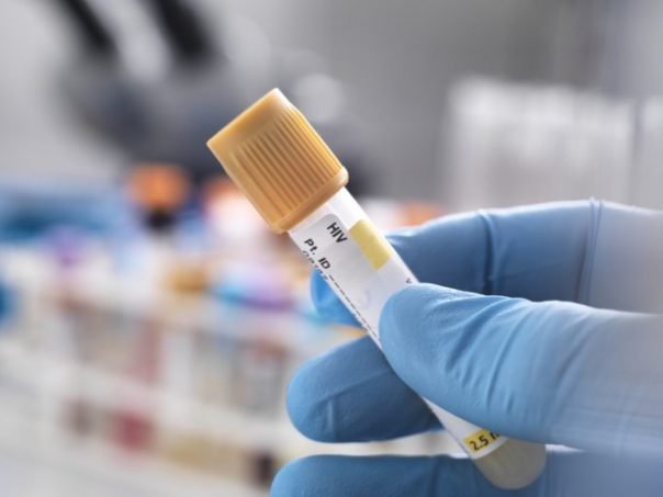 Descoberta Revolucionária: Terapia Contra HIV Controla Vírus por Mais de 1 Ano