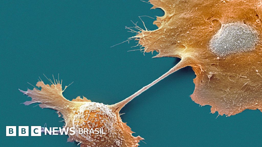 Descubra como funciona a pílula que está revolucionando o tratamento contra o câncer de pâncreas