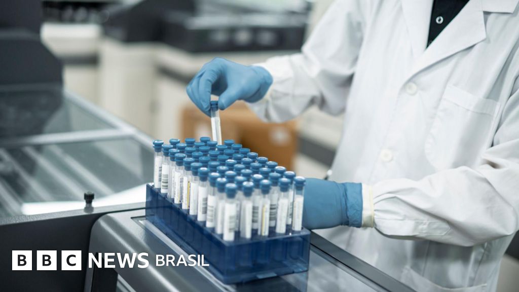 Ebola no Brasil: O Que Você Precisa Saber Sobre o Caso Suspeito em São Paulo