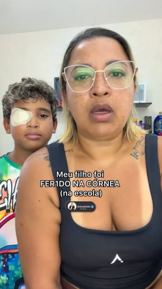 Ferimento na Córnea: Influenciadora Dica da Fabi Alerta sobre Perigos de Brincadeiras Inadequadas