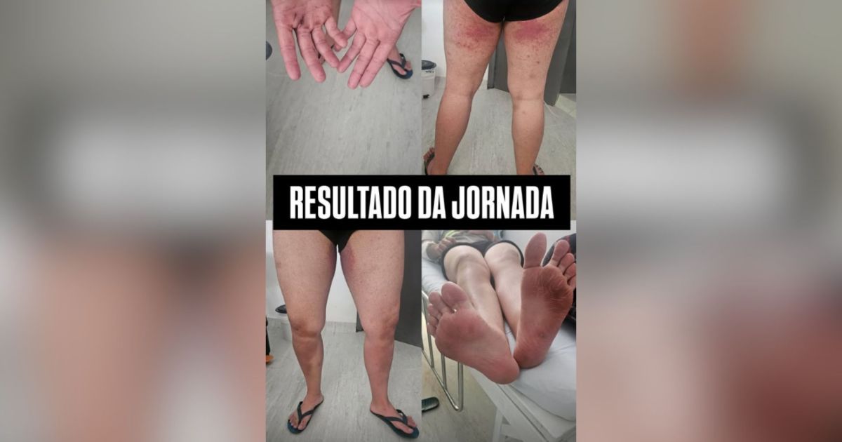 Irmã de jovem desaparecido em trilha posta foto de lesões do irmão; veja