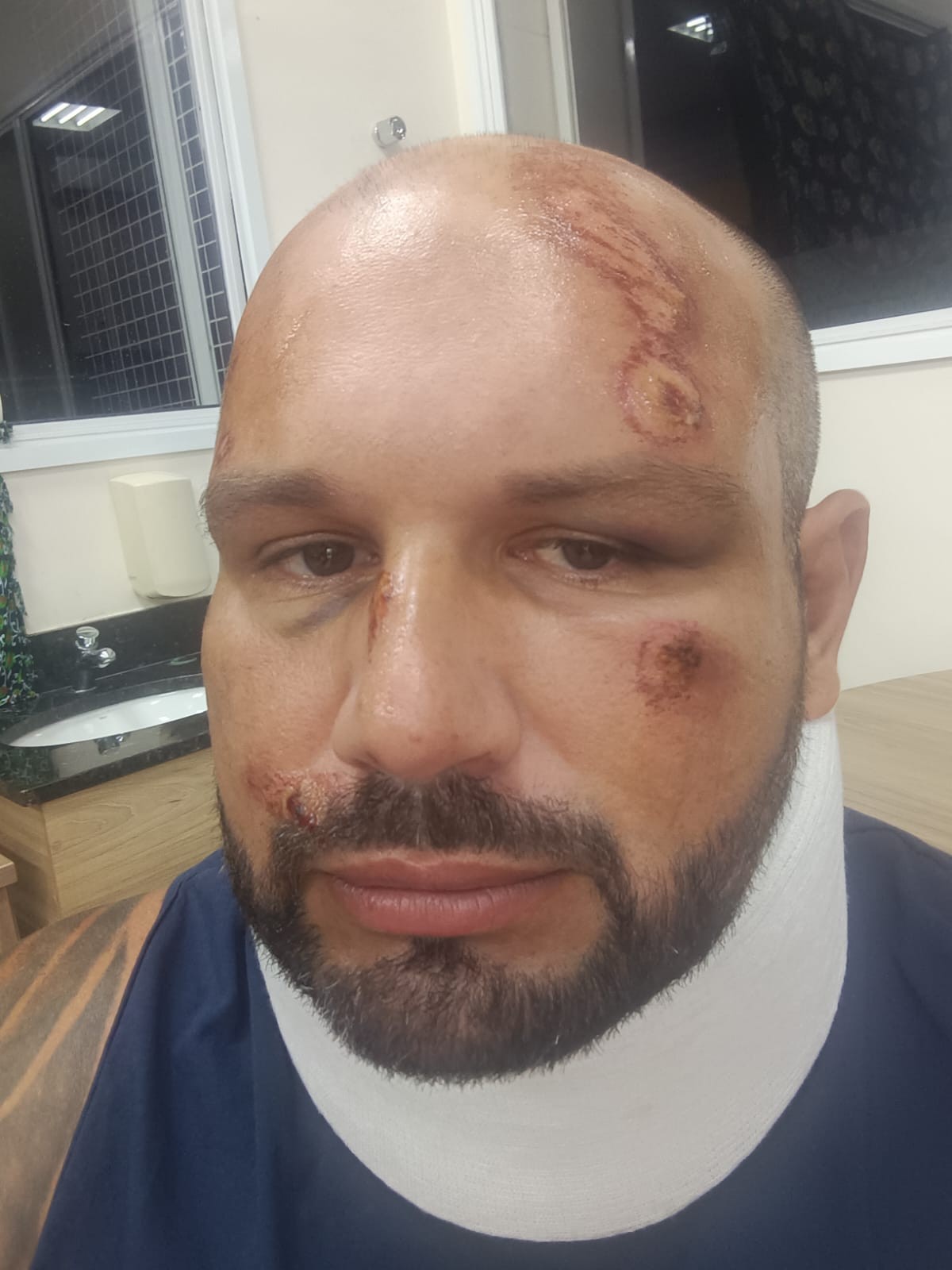 Morte de mulher é 2° acidente com queda pela janela em ônibus da mesma empresa em São Seba