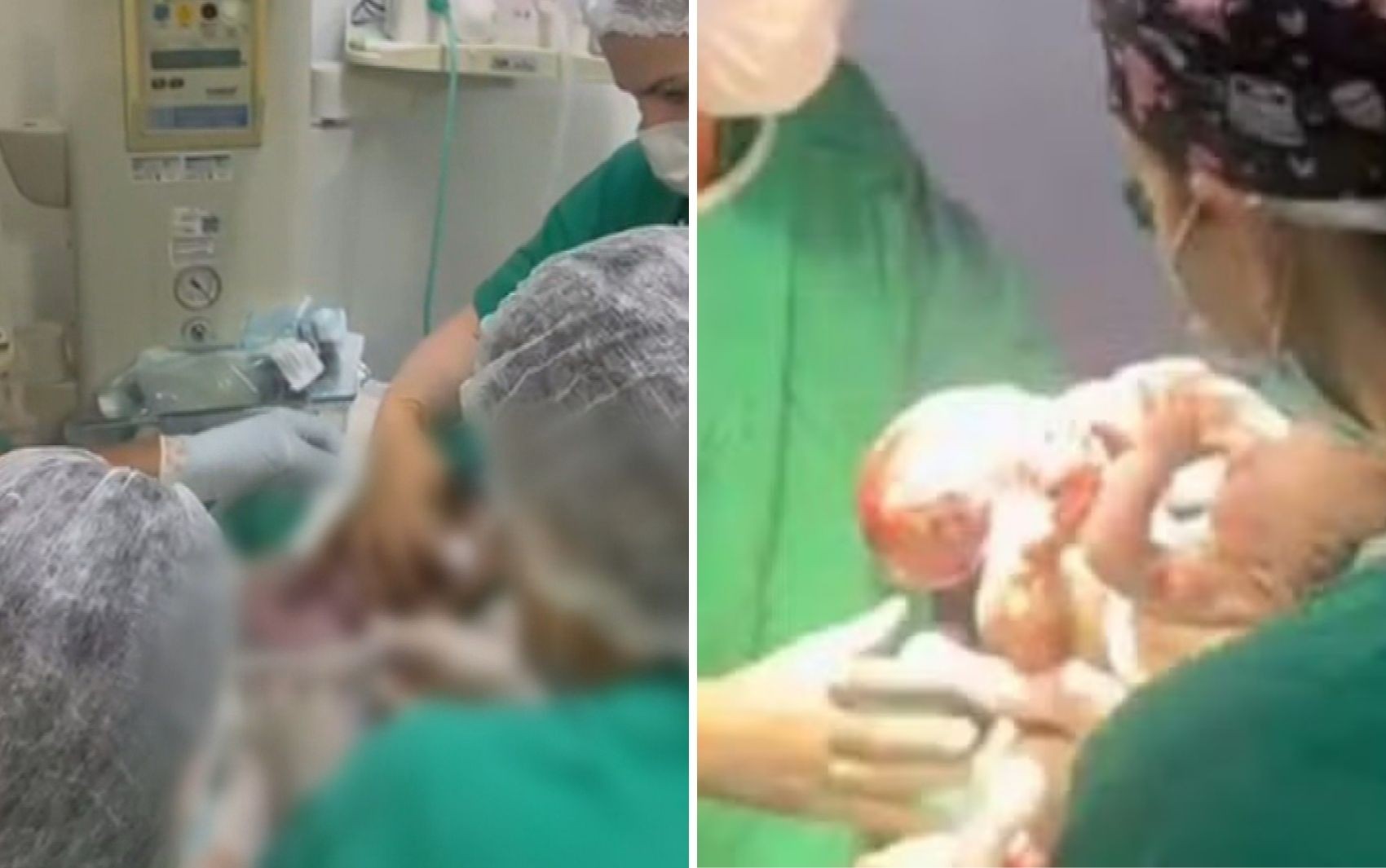 Pai de siameses que nasceram em Goiânia fala sobre ansiedade antes do parto: 'Muita fé em 