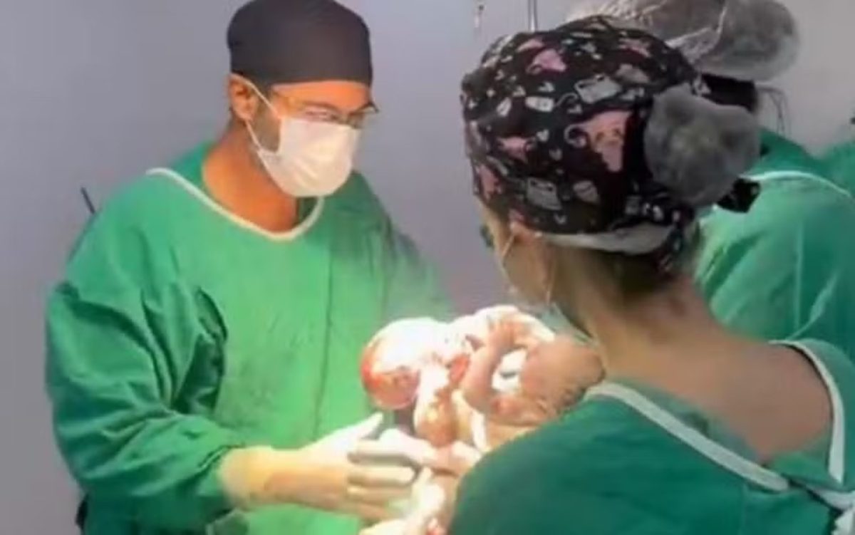 "Papel é tentar salvar a vida", diz médico após morte de siameses