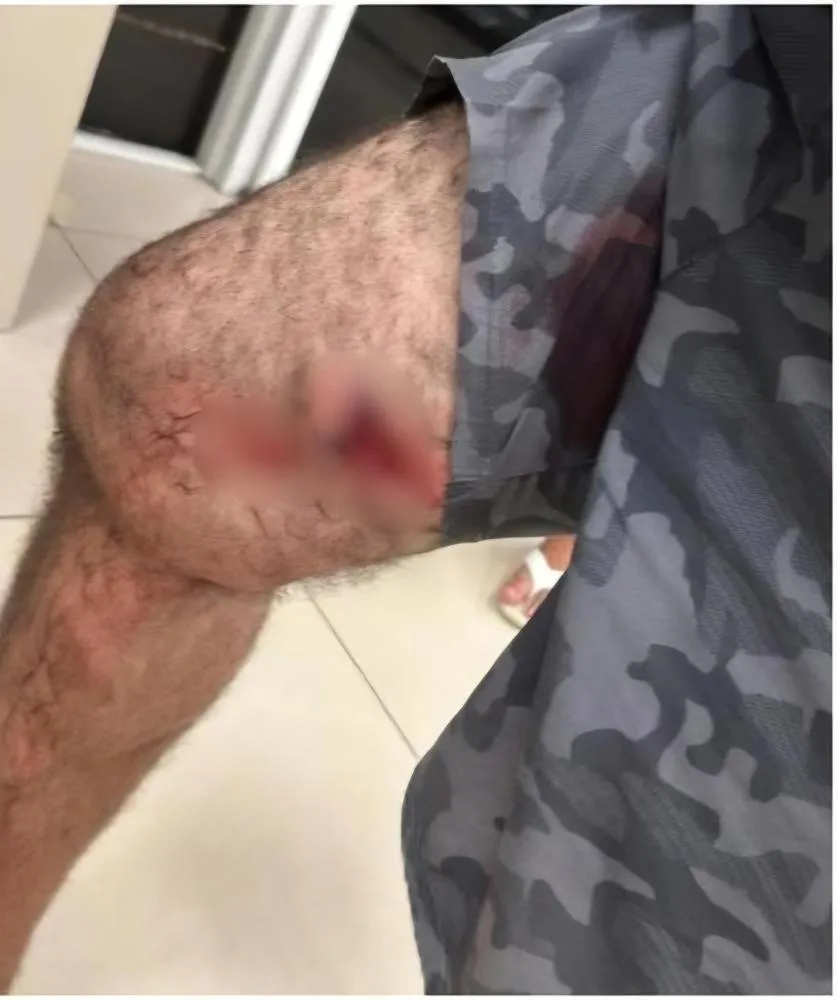Policial Militar Preso: Tiro Acidental durante Discussão em Grande Fortaleza
