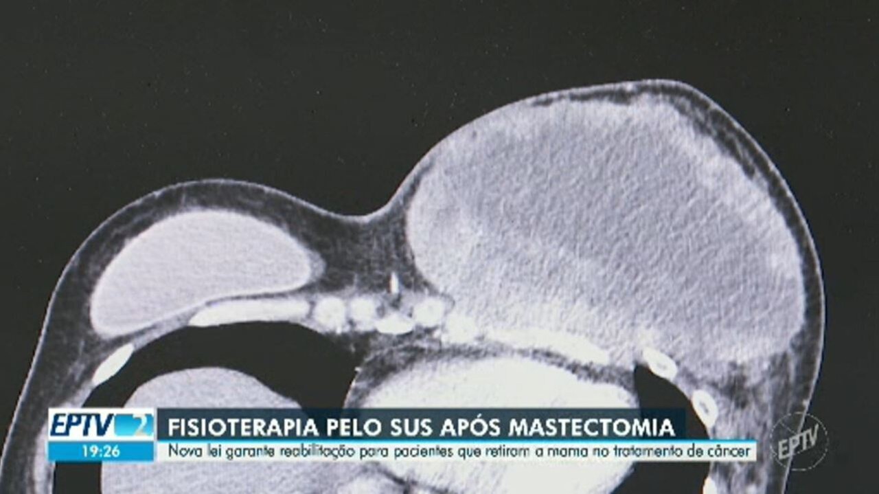 Por que uma mulher de 33 anos decidiu retirar as mamas antes de saber se teria câncer