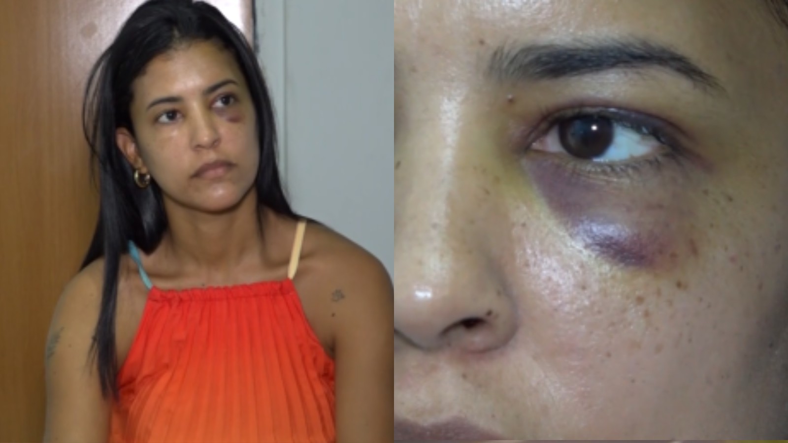 Suspeito de agredir secretária tem alta, presta depoimento e segue em liberdade