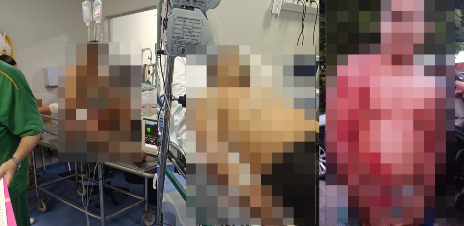 Tentativa de Chacina em Fortaleza: 2 Mortos e 6 Feridos na Lagoa Redonda